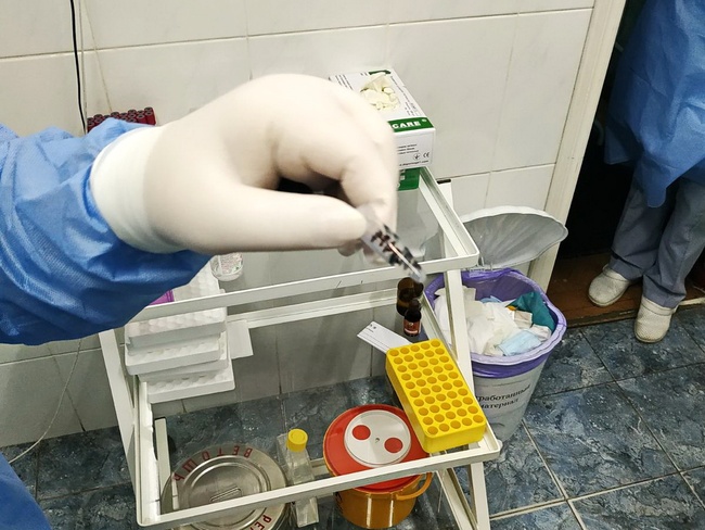 Одеська інфекційна лікарня планує закупити лабораторні реактиви для визначення коронавірусу