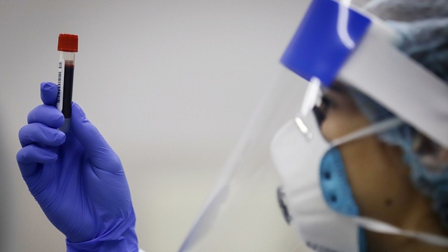 На Одещині за останню добу майже півтори тисячі пацієнтів перемогли коронавірус