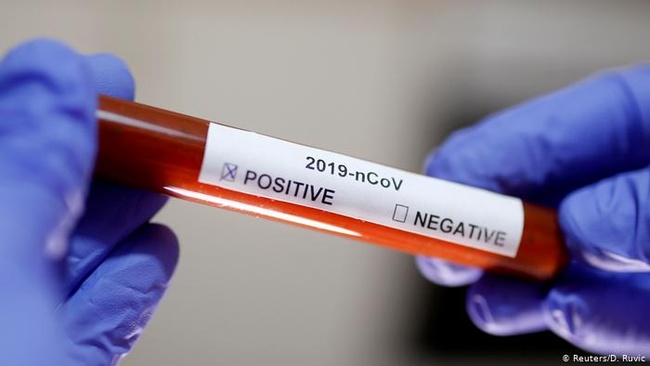 Одесский горсовет купит 10 тысяч тестов для диагностирования коронавируса без тендера