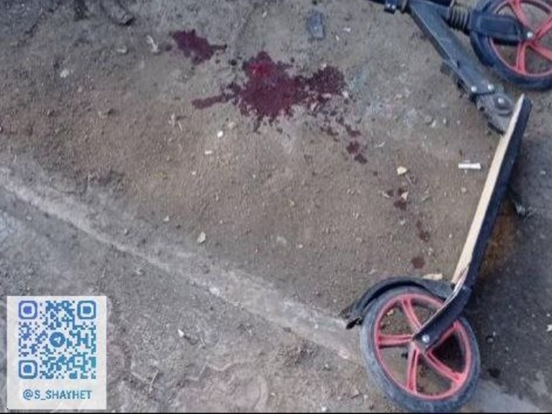 На Миколаївщині біля будинку здетонував снаряд - постраждала дитина