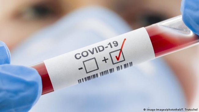 В Україні встановлений антирекорд за кількістю нових випадків COVID-19