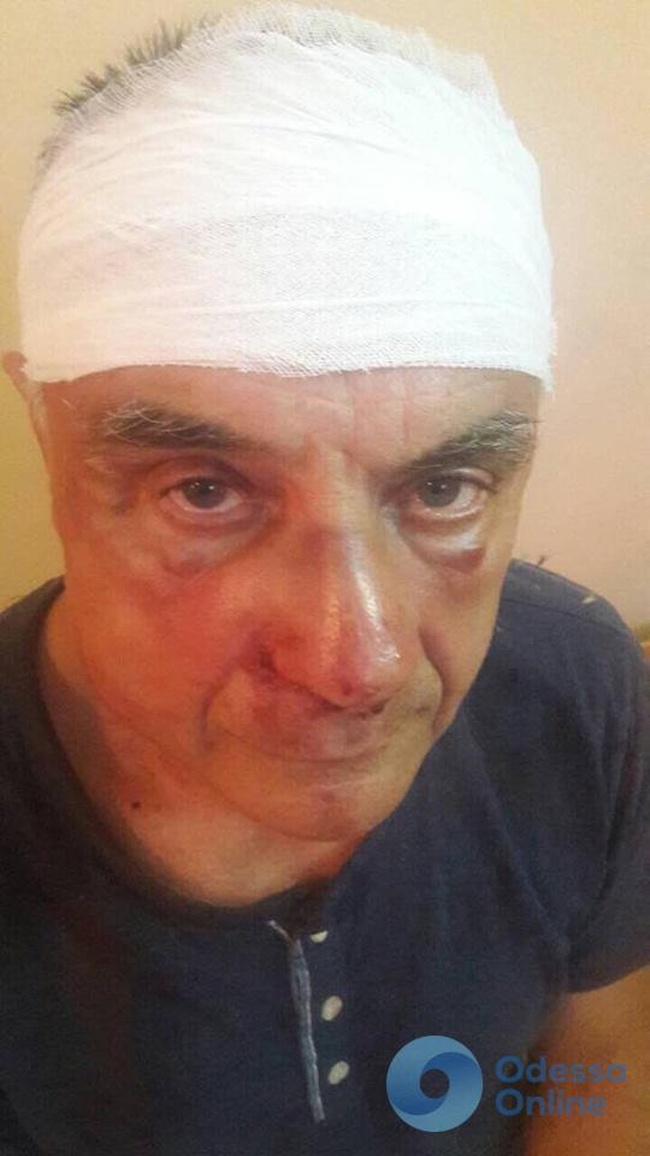 В Измаильском районе избили депутата Одесского областного совета