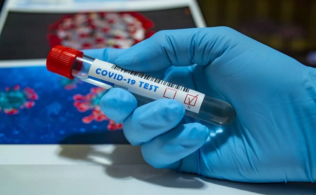 В Одеській області зафіксовано понад 4 тисячі випадків інфікування коронавірусом