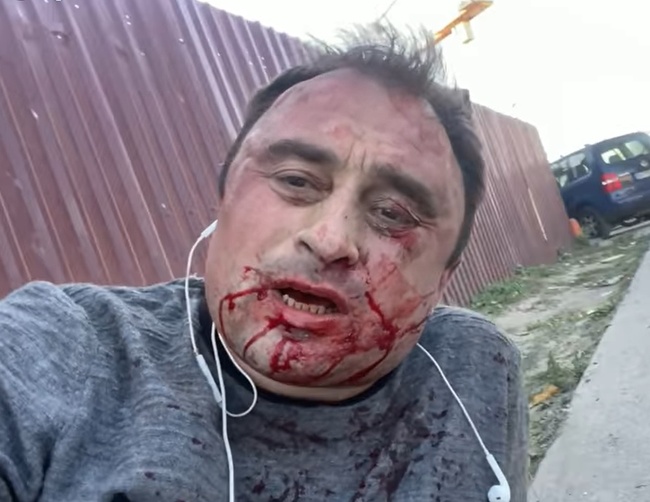 Поліція поки не вирішила, як кваліфікувати напад на ексдепутата районної ради на Одещині