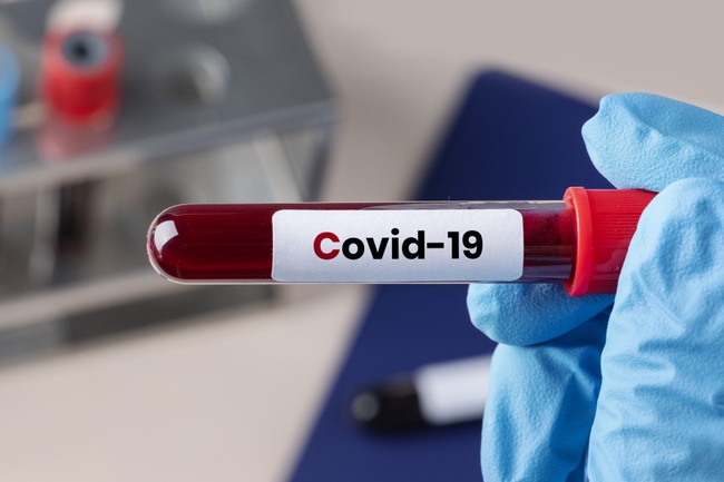 За добу на Одещині не зареєстрували жодної смерті внаслідок COVID-19