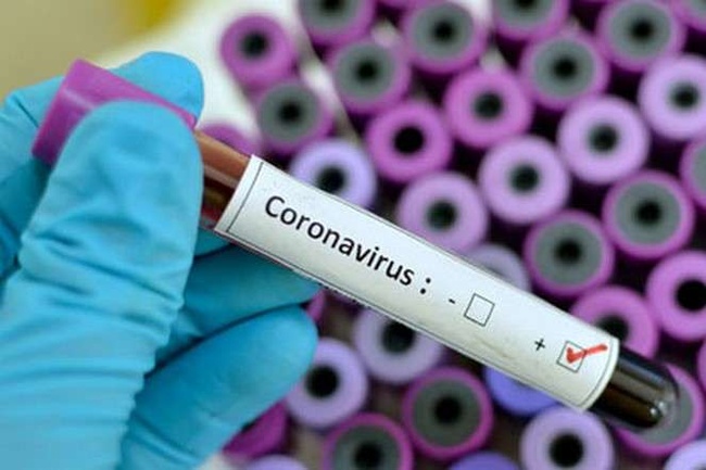 У Сараті зафіксували перший випадок зараження COVID-19