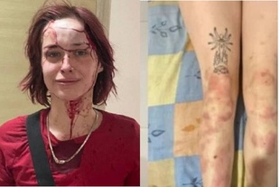 Радять помиритися: нові деталі справи про побиття дівчини працівником ТЦК в Одесі