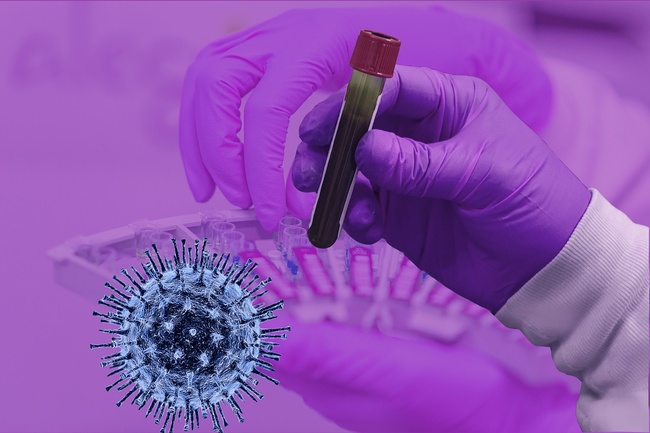 За добу на Одещині виявили 18 випадків коронавірусу, з яких 17 - у Подільську