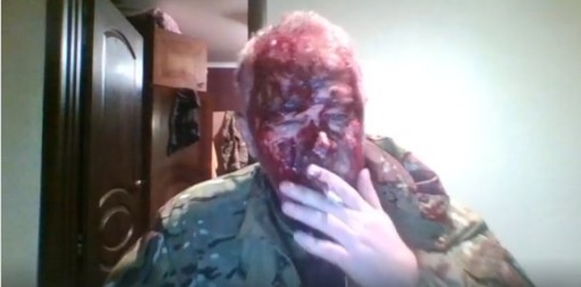 В Одесской области избили ветерана АТО