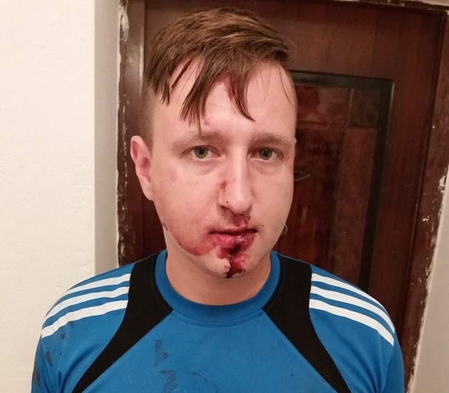 В Одессе избили и ограбили журналиста
