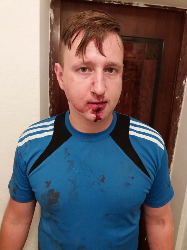 Нападение на журналиста в Одессе  квалифицировали как разбой