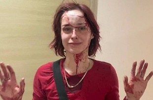 Побиття дівчини працівником ТЦК в Одесі: в ОК "Південь" назвали відео "роботою на ворога"