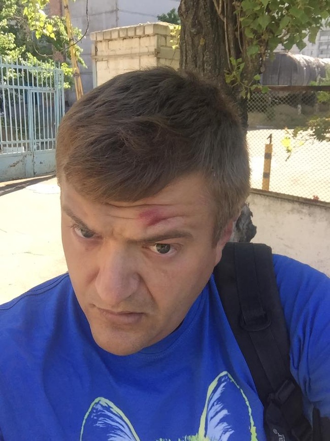 Избитый в Херсоне журналист утверждает, что на него напали те же, кто резал Устименко
