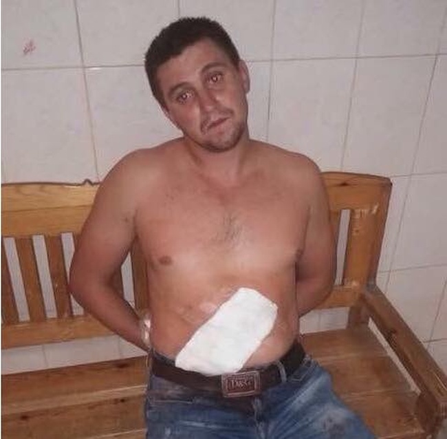 Выжившему участнику нападения на Стерненко выделили охрану