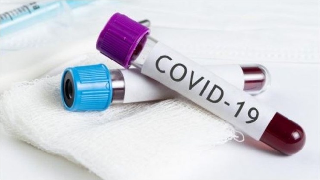 Кількість інфікованих коронавірусом на Одещині зросла на 42 особи за добу