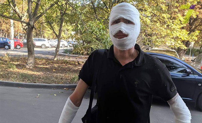 Ожоги лица и шеи: одессит обрызгал журналиста из газового баллончика